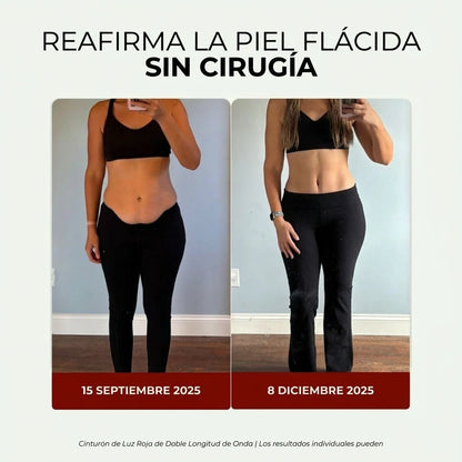 Faja de Luz Roja para Reafirmar el Abdomen y Recuperar la Confianza